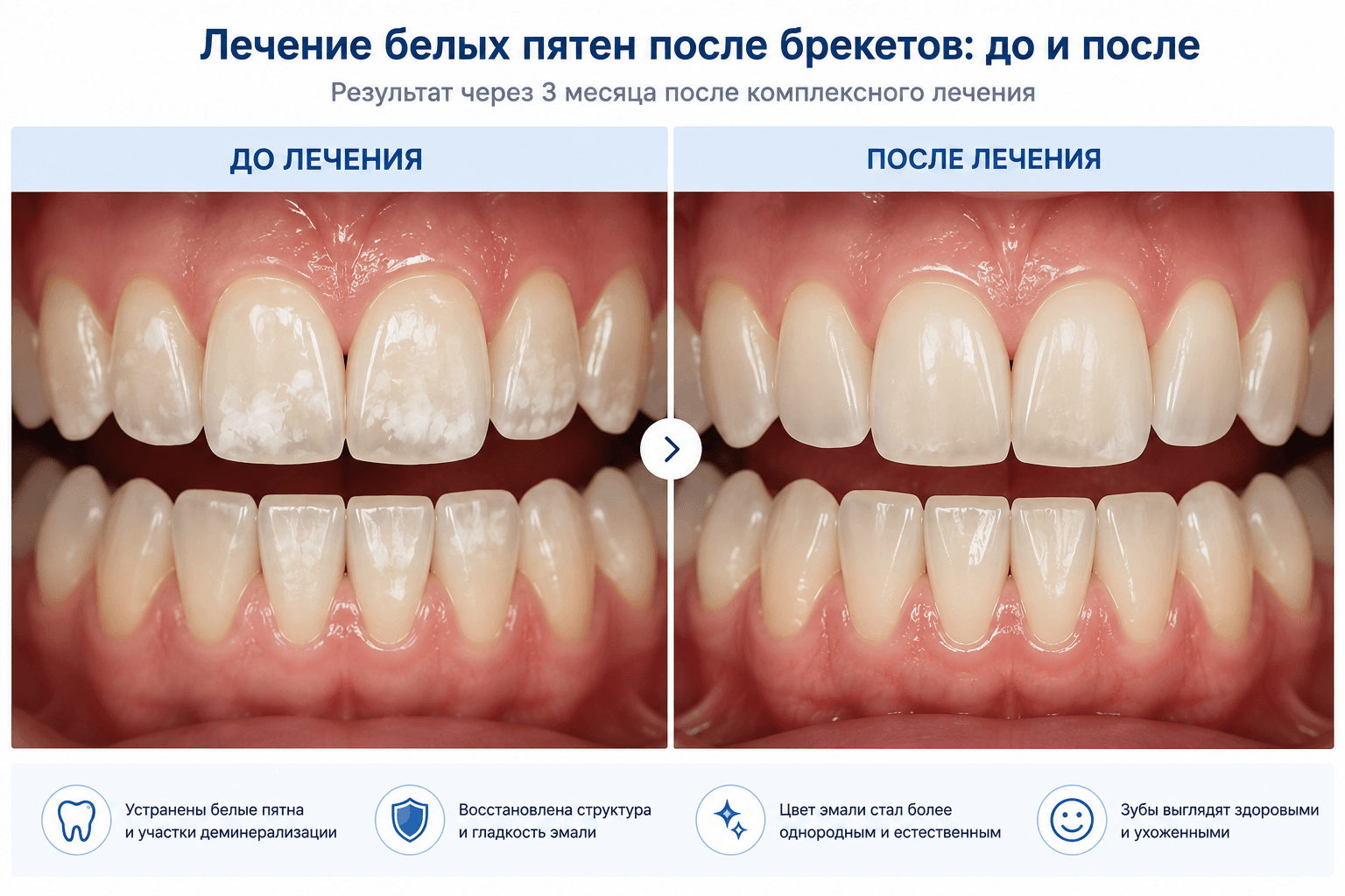 до и после лечения белых пятен