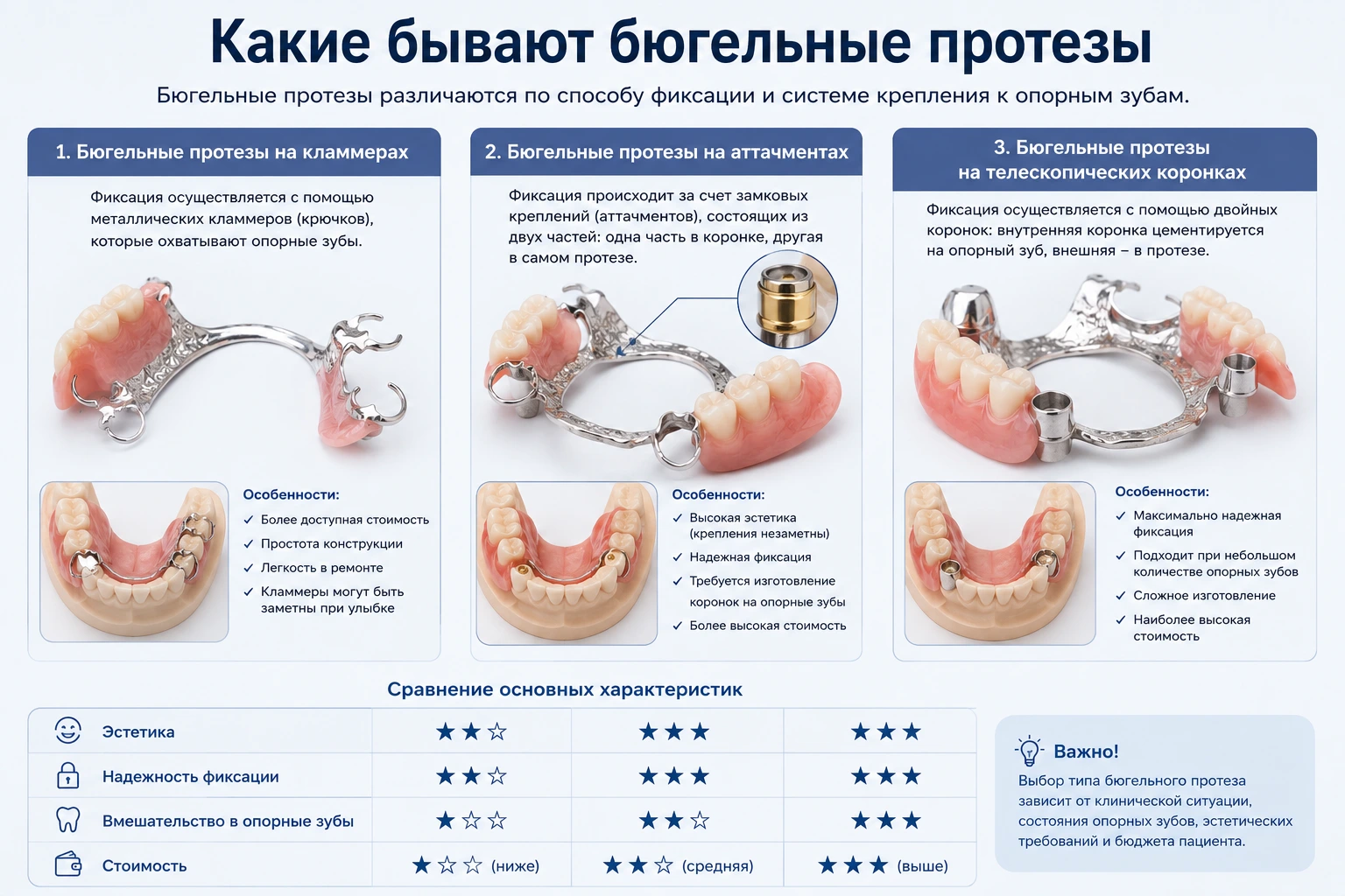 Какие бывают бюгельные протезы