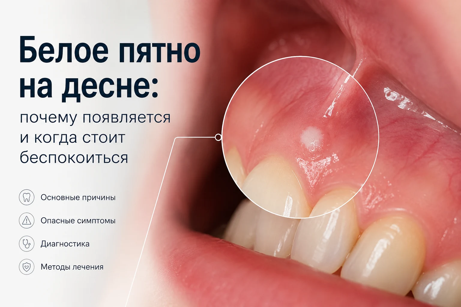 Белое пятно на десне возле зуба - возможные причины и диагностика